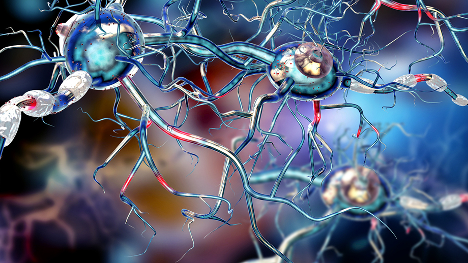 Bei der Multiplen Sklerose greift das Immunsystem die Myelinhülle der Nervenfasern an (weiß), Credit: Ralwel/iStockphoto