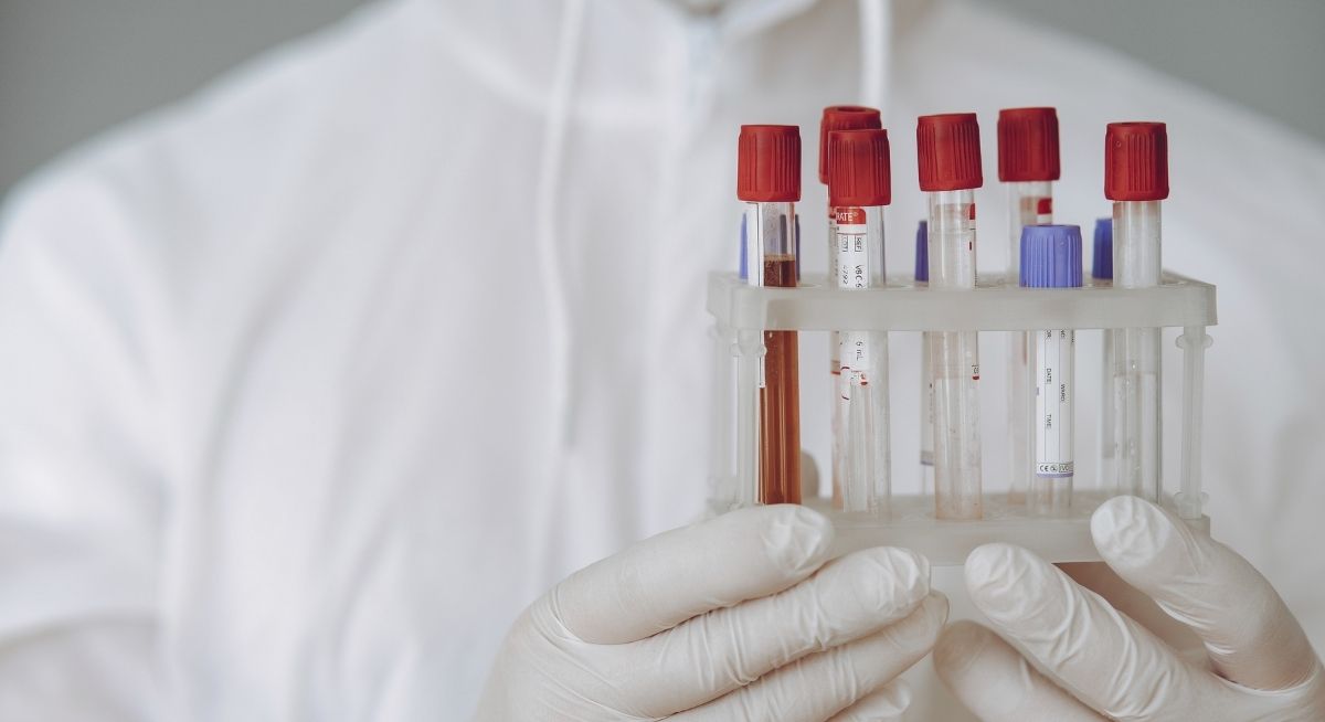 Labormitarbeiter mit Blutproben, Foto: Pexels